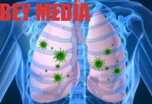 Pnevmoniya haqqinda her sey BEY.AZ