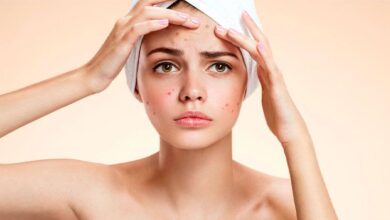 how to know acne cover 780x420 1
